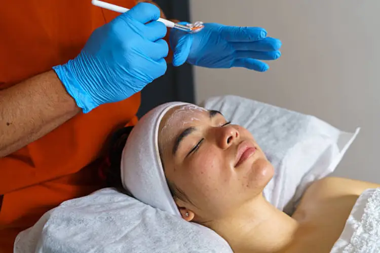 Acne Facial (3)